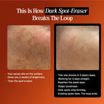 Before and after comparison of dark spots on skin with text about a dark spot eraser.