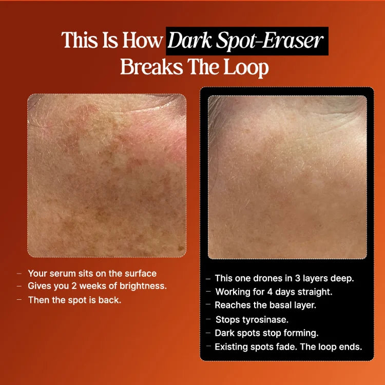 Before and after comparison of dark spots on skin with text about a dark spot eraser.